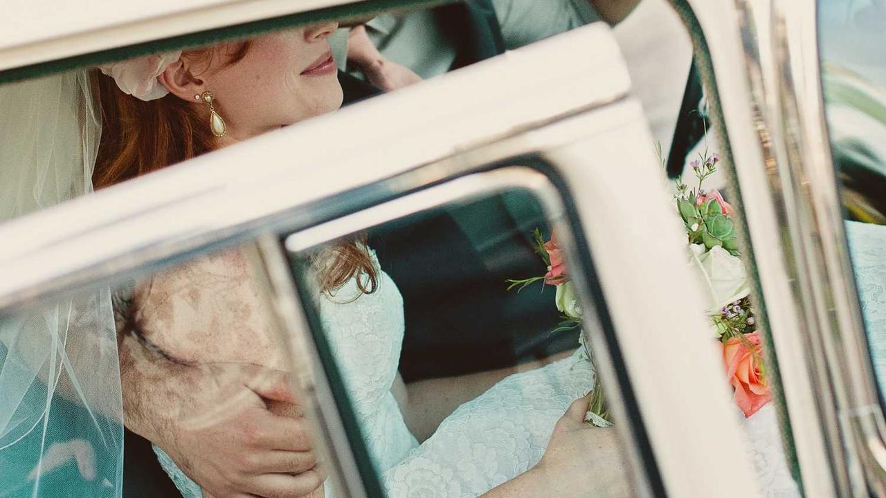 치센 효과와 가격, 부작용까지 완벽 정리: 말 못 할 고통 치질, 먹는 약으로 해결할 수 있을까?